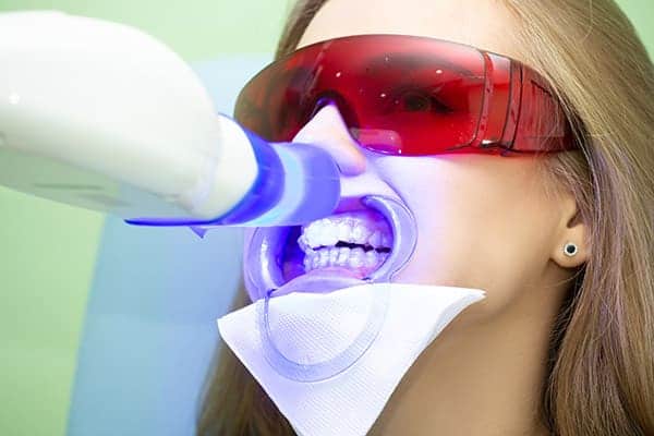 Laser teeth whitening treatments Sussex