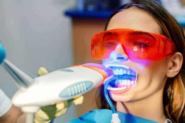 Simplifying Teeth Whitening: A Comprehensive Guide Sussex