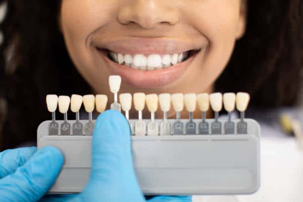 Laser Teeth Whitening: Exploring the Longevity of Your Brighter Smile Sussex