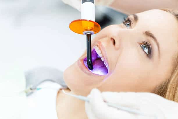 Unveiling the Cost of Laser Teeth Whitening in the UK Sussex