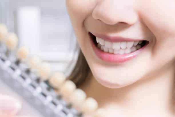 Teeth Whitening Kings Norton Sussex