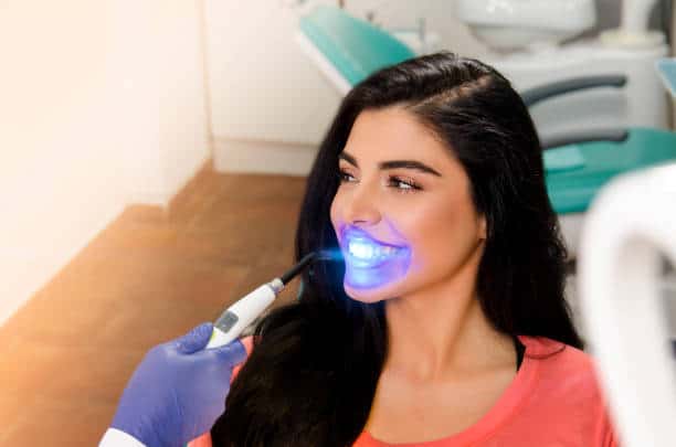 Top Teeth Whitening Systems for a Brighter Smile Sussex