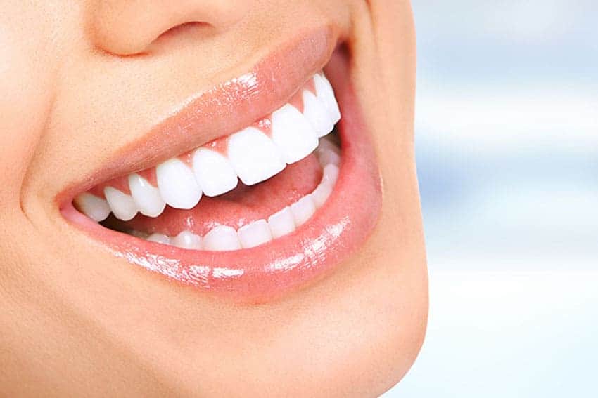 Teeth Whitening Abingdon Sussex