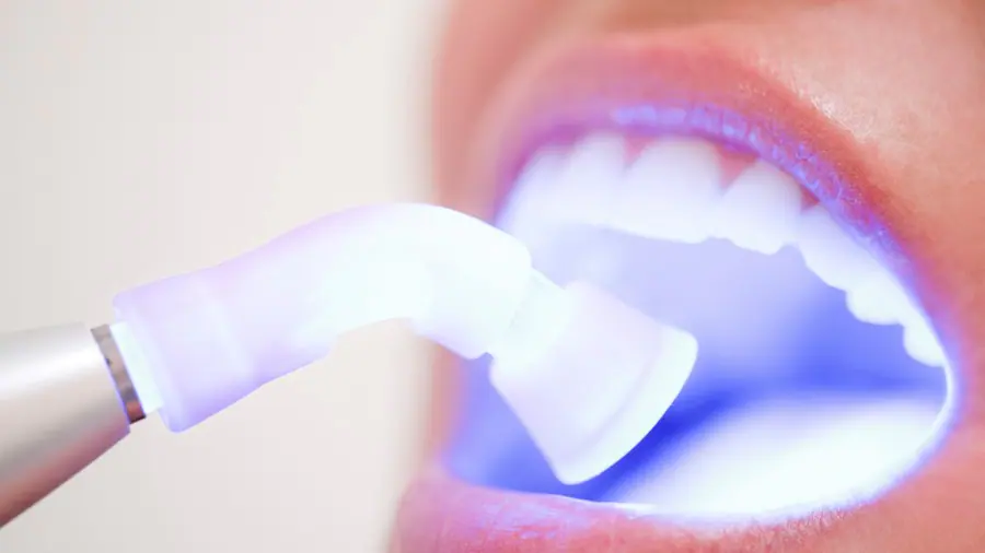 Teeth Whitening Aylesbury Sussex