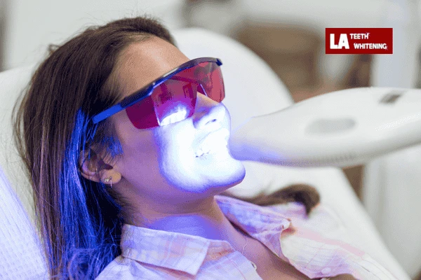 Are you looking for professional whitening Sussex for your teeth? Sussex